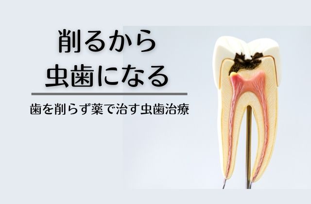 高松市で削らない虫歯治療なら吉本歯科医院｜抜かずに歯を残す